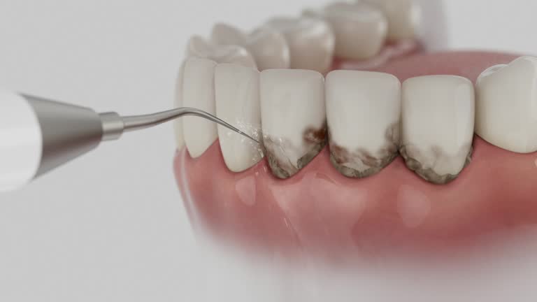 Trusted Dental Implants service in Bowman, ND - Dentist Open Now